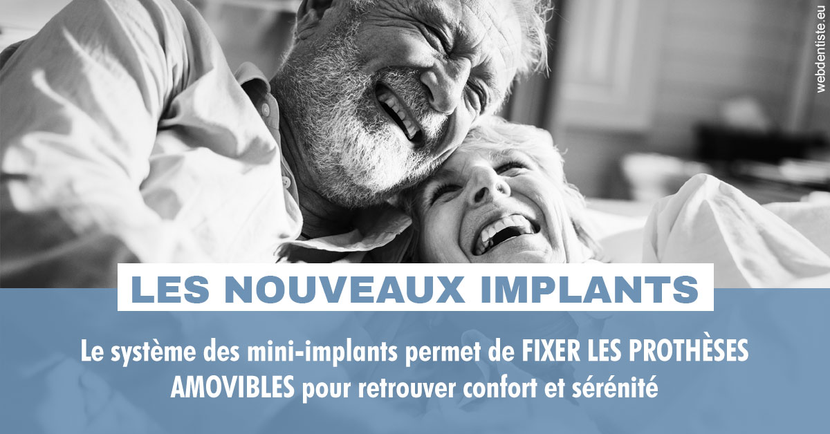 https://www.clinique-dentaire-lugari-garlaban.fr/Les nouveaux implants 2