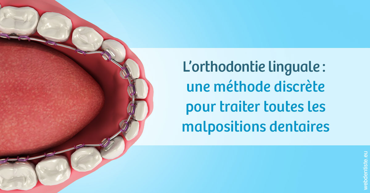 https://www.clinique-dentaire-lugari-garlaban.fr/L'orthodontie linguale 1