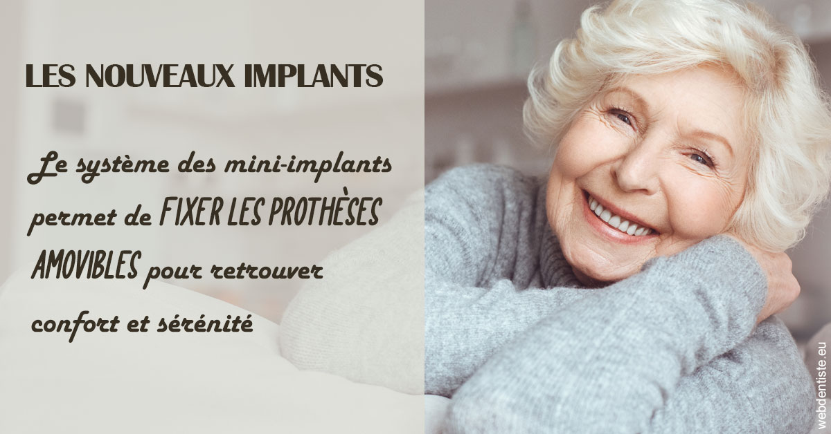 https://www.clinique-dentaire-lugari-garlaban.fr/Les nouveaux implants 1