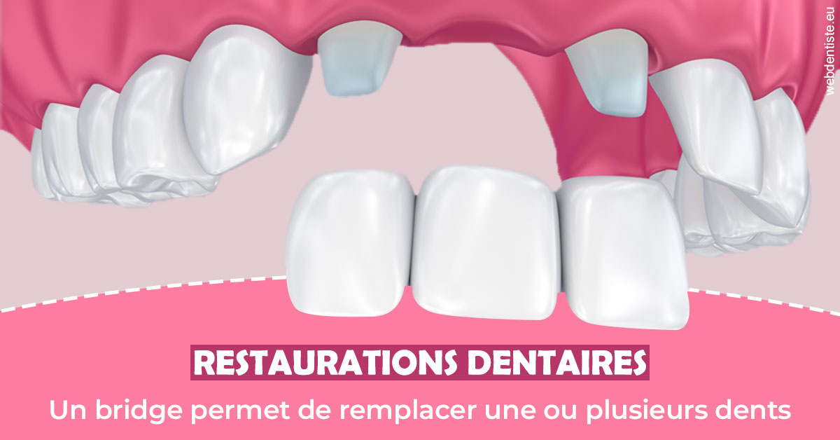 https://www.clinique-dentaire-lugari-garlaban.fr/Bridge remplacer dents 2
