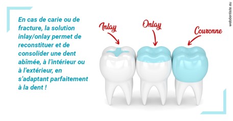 https://www.clinique-dentaire-lugari-garlaban.fr/L'INLAY ou l'ONLAY