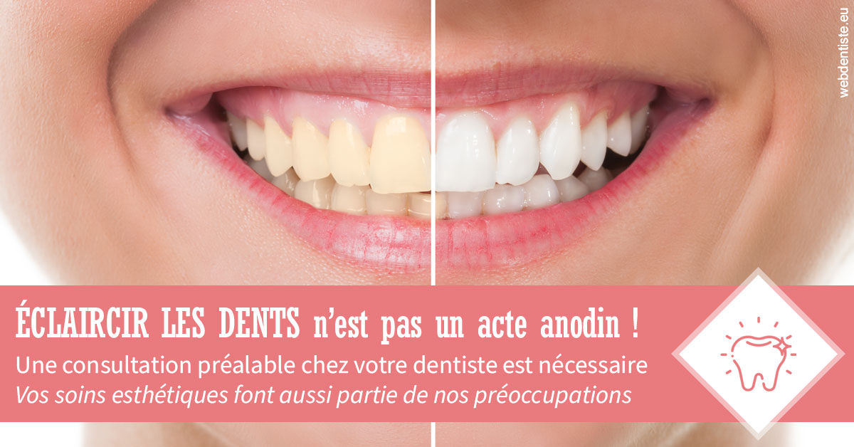 https://www.clinique-dentaire-lugari-garlaban.fr/Eclaircir les dents 1