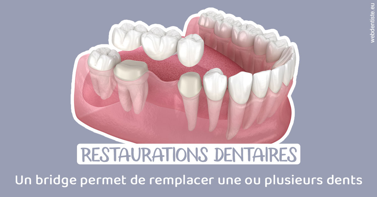 https://www.clinique-dentaire-lugari-garlaban.fr/Bridge remplacer dents 1