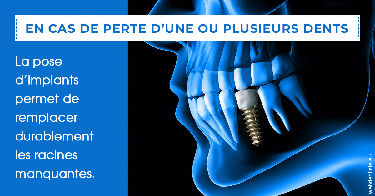 https://www.clinique-dentaire-lugari-garlaban.fr/2024 T1 - Implants 01
