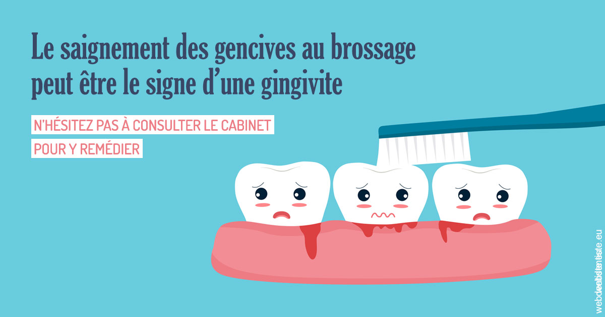 https://www.clinique-dentaire-lugari-garlaban.fr/Saignement gencives 2