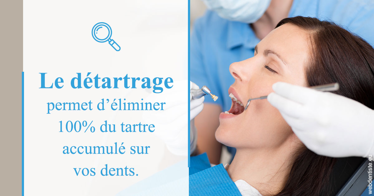https://www.clinique-dentaire-lugari-garlaban.fr/En quoi consiste le détartrage