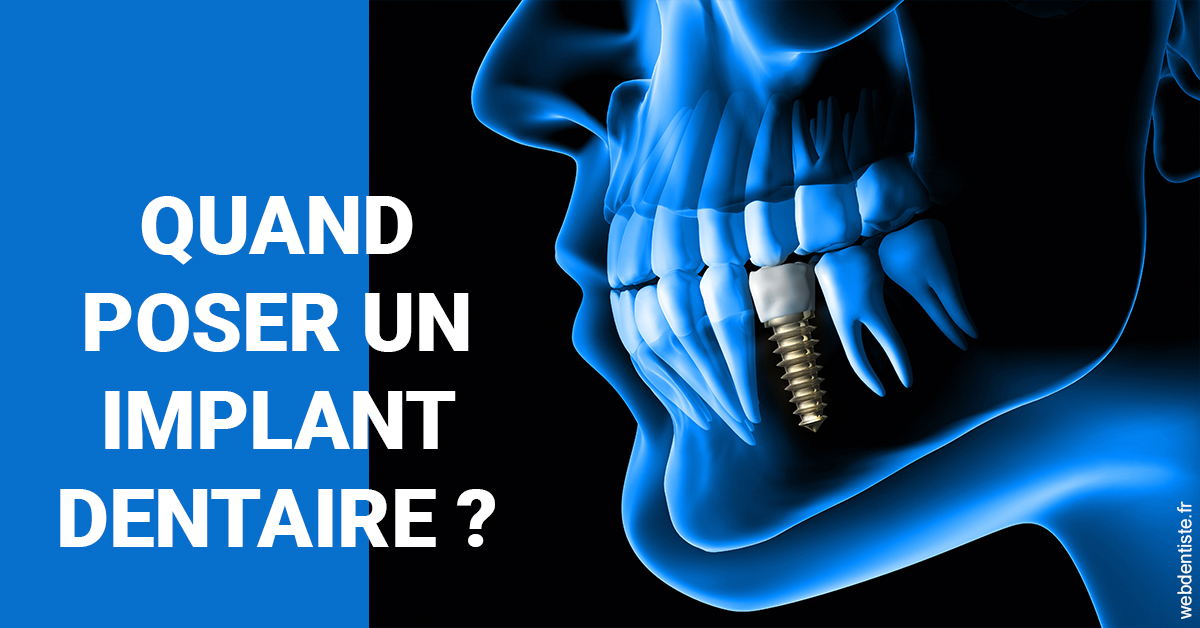 https://www.clinique-dentaire-lugari-garlaban.fr/Les implants 1