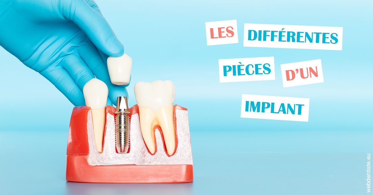 https://www.clinique-dentaire-lugari-garlaban.fr/Les différentes pièces d’un implant 2