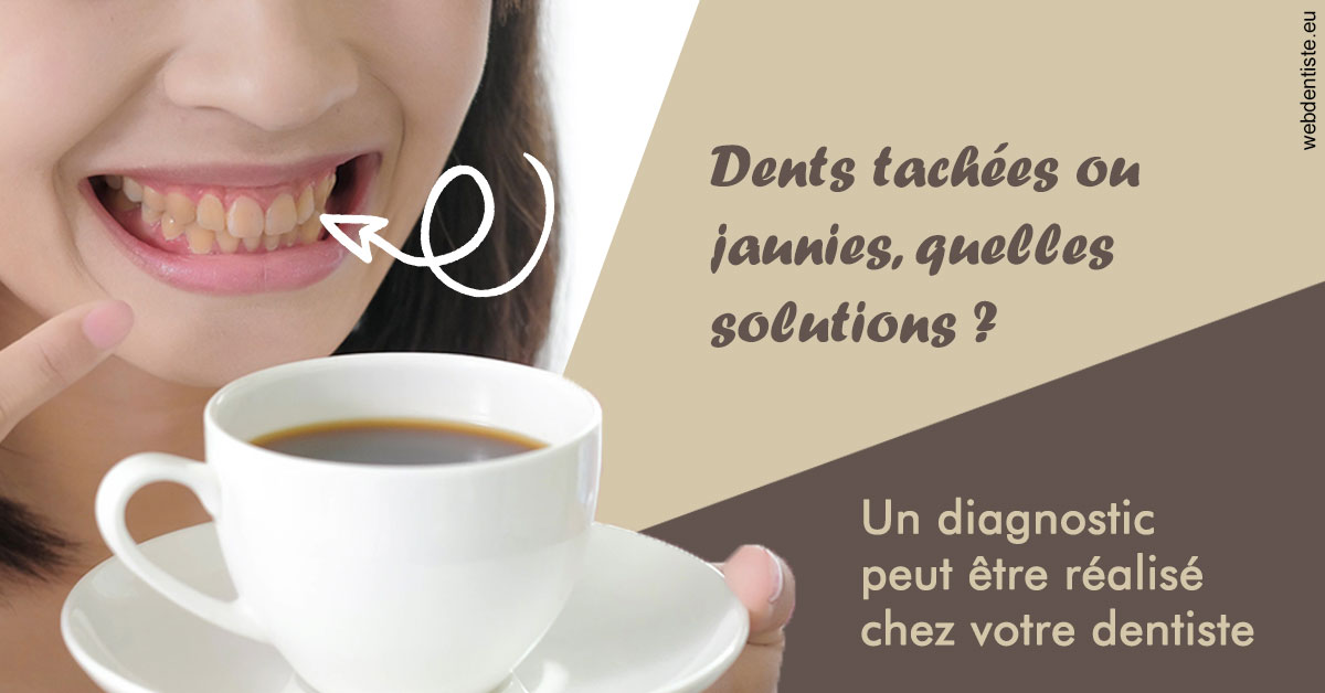 https://www.clinique-dentaire-lugari-garlaban.fr/Dents tachées 1
