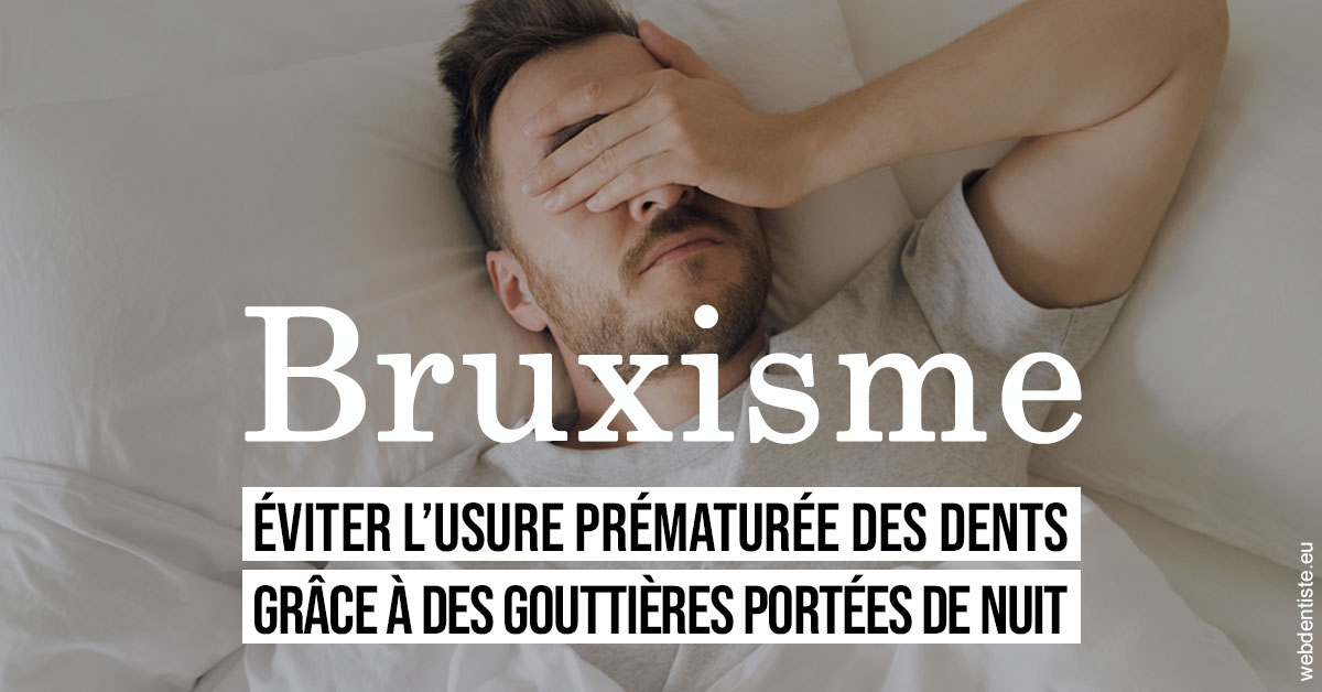 https://www.clinique-dentaire-lugari-garlaban.fr/Bruxisme 1