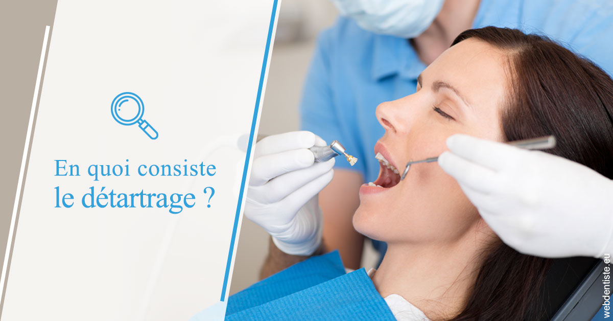 https://www.clinique-dentaire-lugari-garlaban.fr/En quoi consiste le détartrage