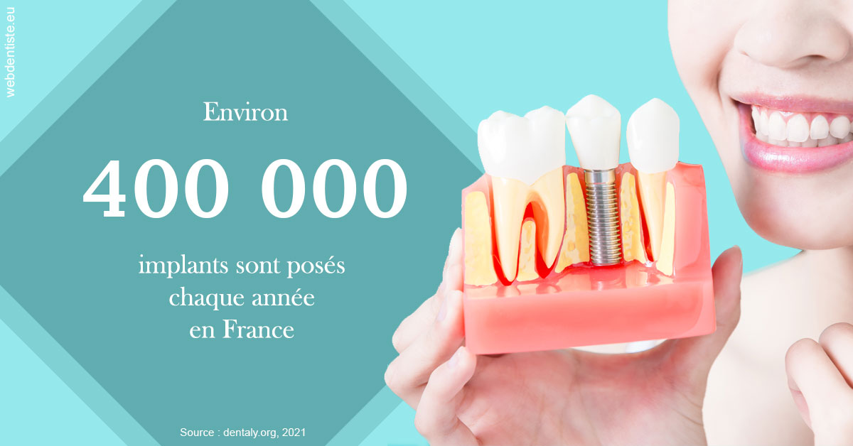 https://www.clinique-dentaire-lugari-garlaban.fr/Pose d'implants en France 2