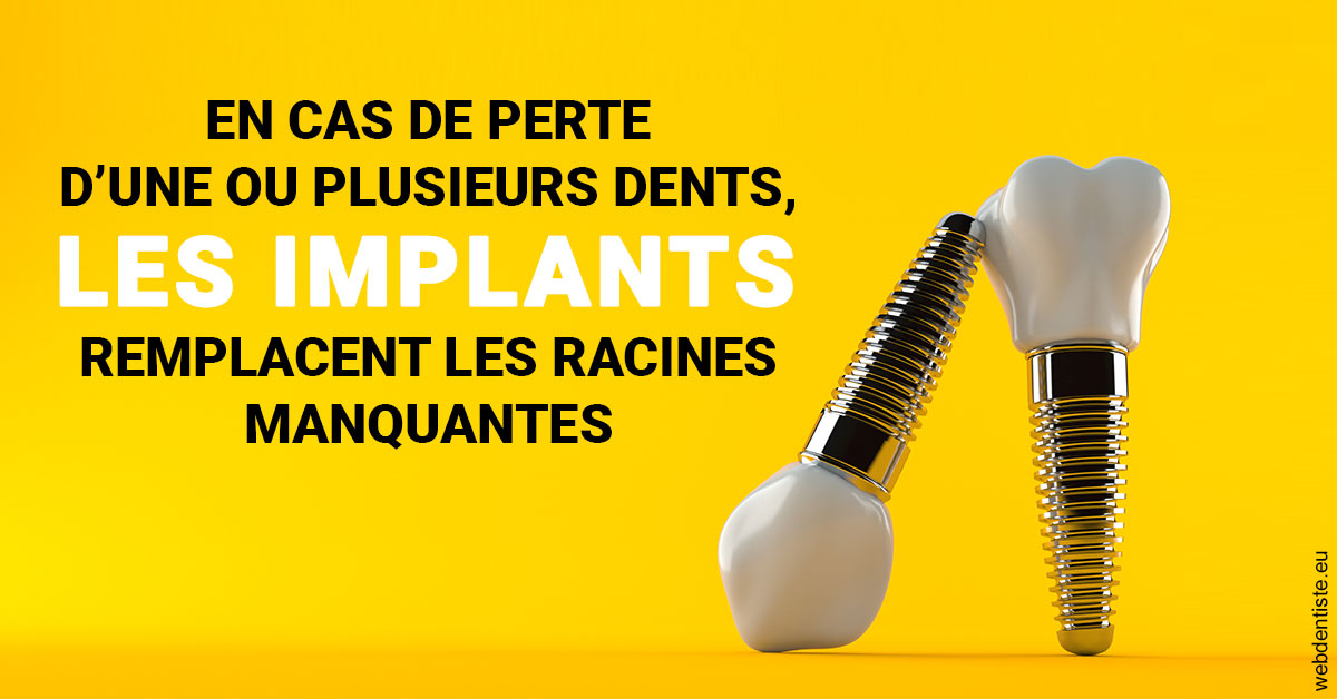 https://www.clinique-dentaire-lugari-garlaban.fr/Les implants 2