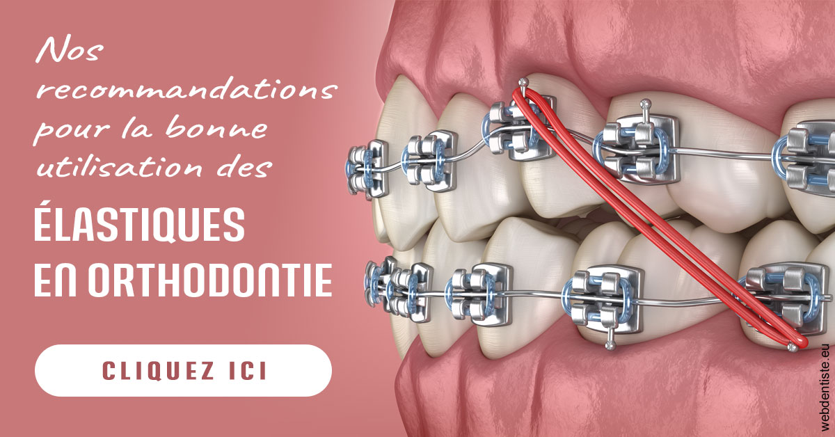 https://www.clinique-dentaire-lugari-garlaban.fr/Elastiques orthodontie 2